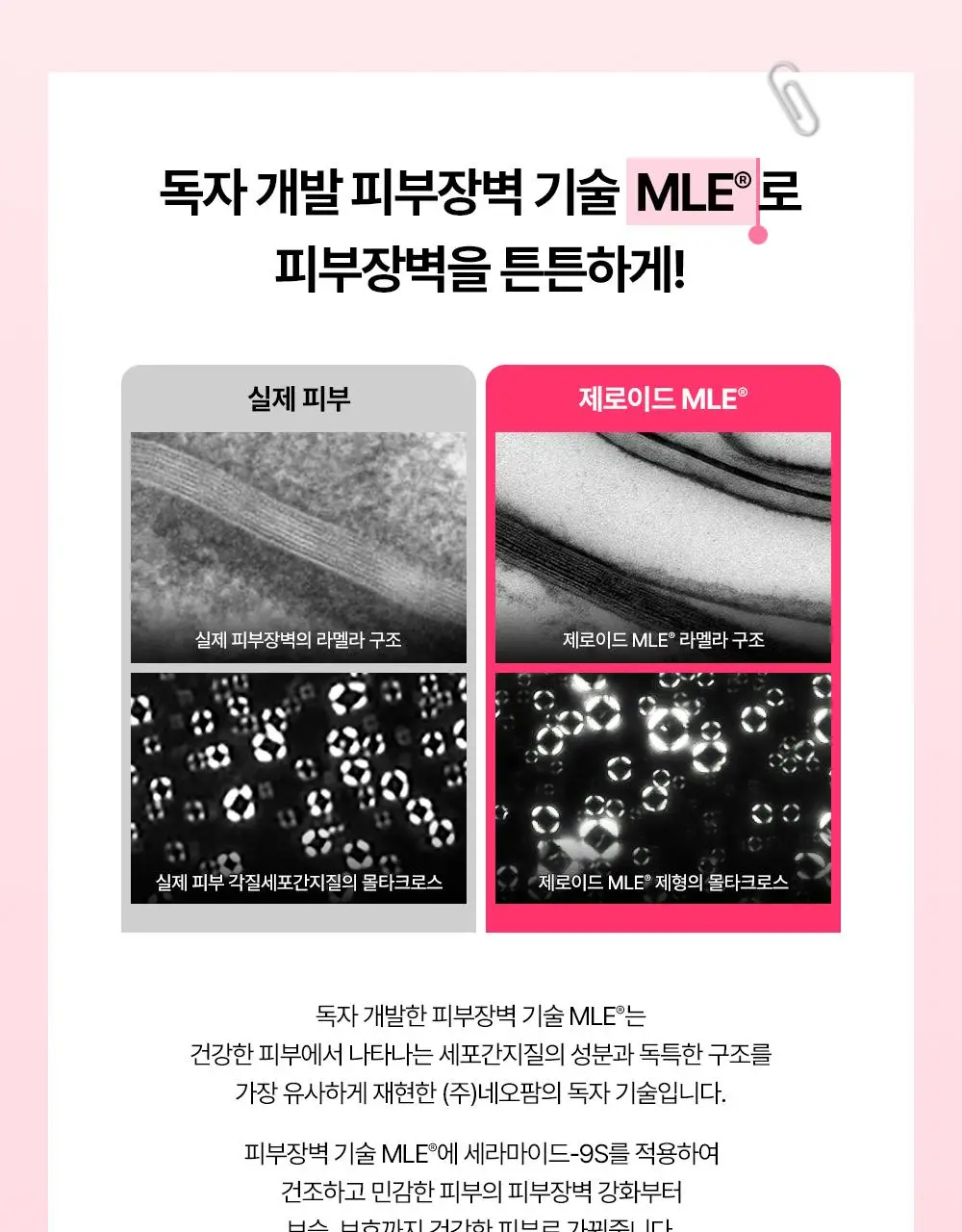 [트러블피부 추천] 제로이드 핌프로브 레드 컨트롤 크림 pH4 80ml 기획 (+ 젤클렌저 25ml) 상세페이지 32